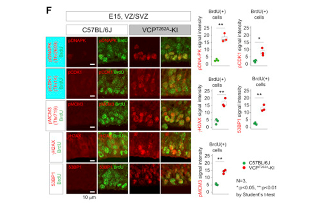 Immunofluorescence using DNA PKcs pT2609